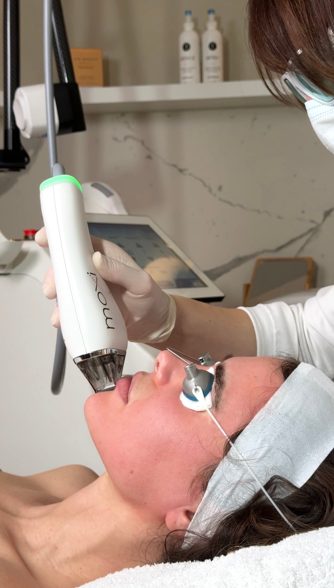 Moxi Laser treatment at TEUTÉ Advanced Aesthetics, Prishtina