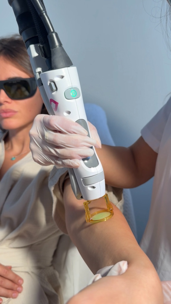 Candela GentleMax Pro Plus treatment at TEUTÉ Advanced Aesthetics, Prishtina